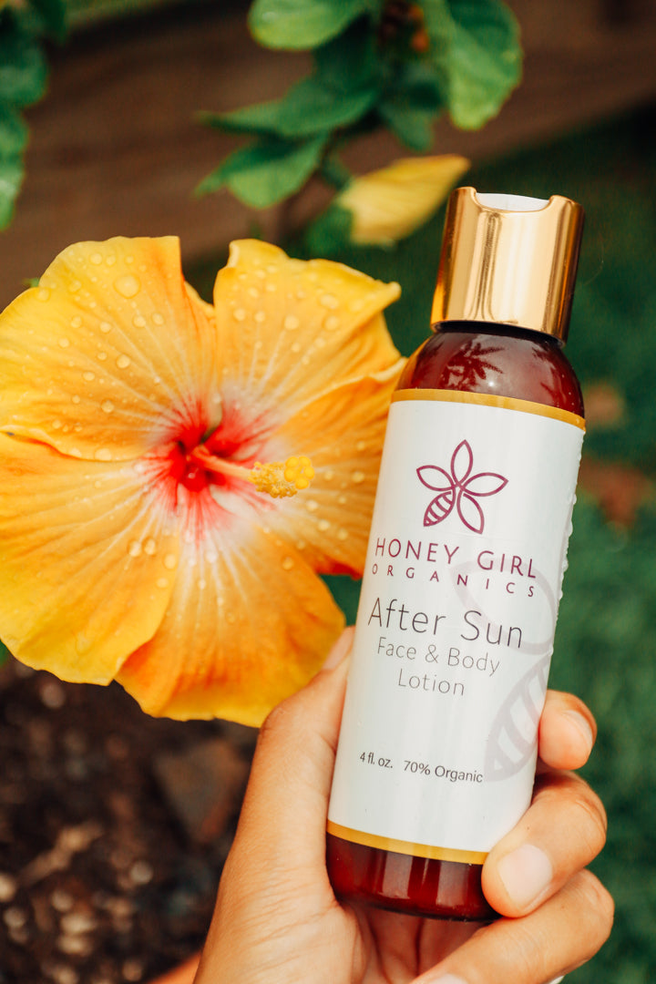 Soothing your Sunburn: Honey Girl Organics After Sun